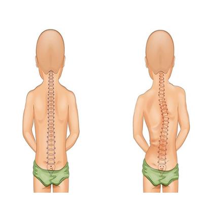Tác Hại Khi Nằm Sai Loại Đệm – Cảnh Báo Cho Giấc Ngủ Và Sức Khỏe