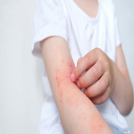 Ngủ Trên Đệm Cao Su Có Gây Dị Ứng Không? Sự Thật Bạn Nên Biết